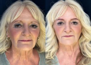 kaiserberg neudorf palast of beauty beste studio