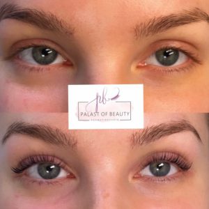 Wimpernlifting