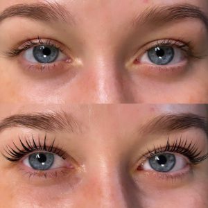 Wimpernlifting