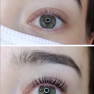 Wimpernlifting