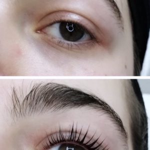 Wimpernlifting
