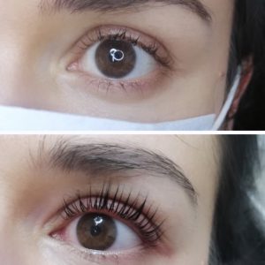 Wimpernlifting