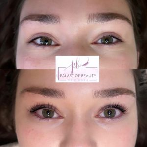 Wimpernlifting