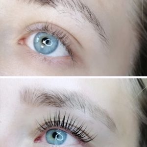Wimpernlifting