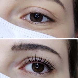 Wimpernlifting