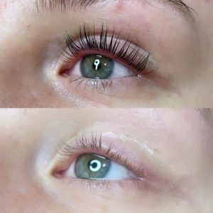 Wimpernlifting