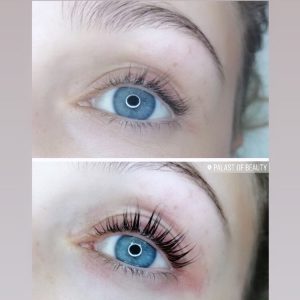 Wimpernlifting