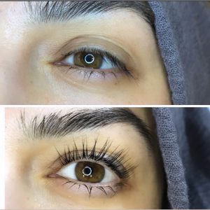 Wimpernlifting