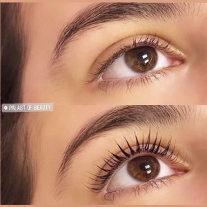 Wimpernlifting