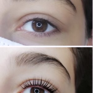 Wimpernlifting