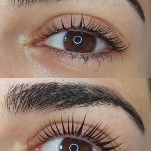 Wimpernlifting