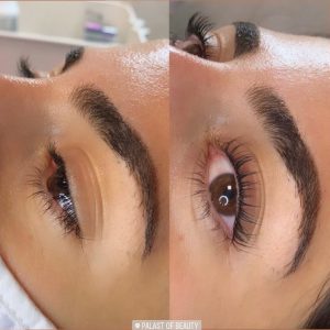 Wimpernlifting