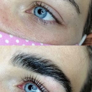 Wimpernlifting