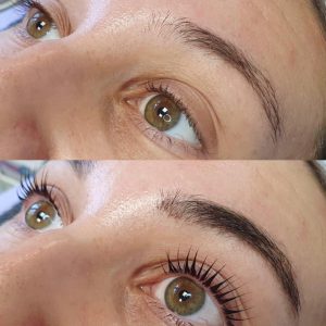 Wimpernlifting