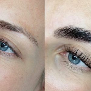 Wimpernlifting