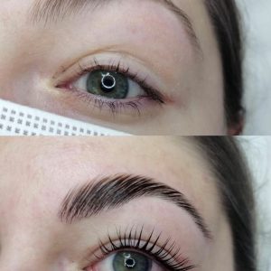 Wimpernlifting